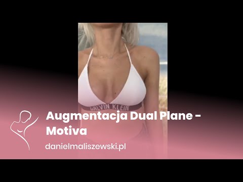 Augmentacja Dual Plane - Motiva | dr Daniel Maliszewski