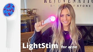 LightStim for Acne handheld low level light therapy device.