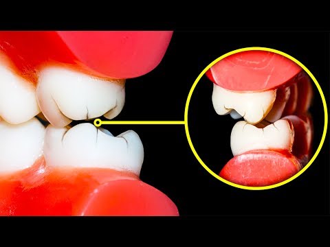 Vidéo: Comment Arrêter De Grincer Les Dents La Nuit Et Pendant La Journée
