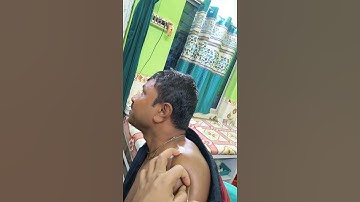 IM Injection  #iminjection #deltoidinjection #injection