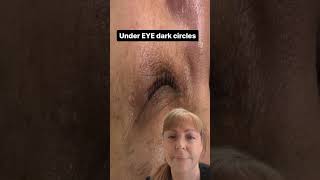 Dark under EYE circles by Nerida Joy 1,950 views 1 year ago 1 minute, 30 seconds