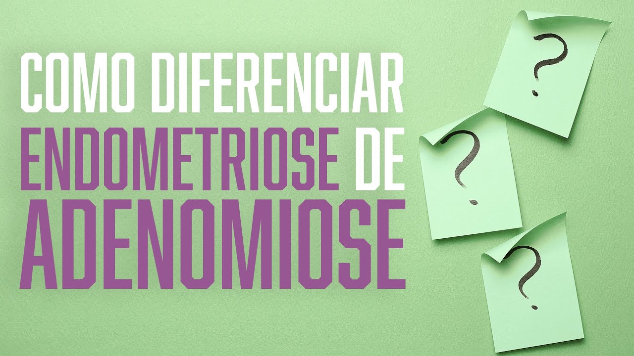 Qual a diferença entre ENDOMETRIOSE E ADENOMIOSE? Como É Feito O Diagnóstico? |  Dr. André Vinícius