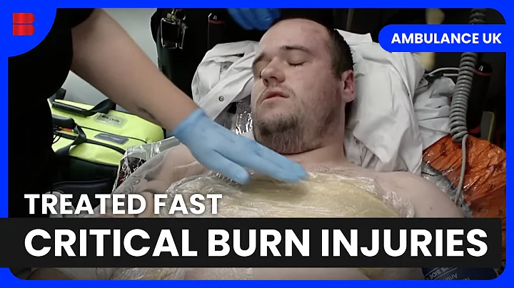 Burn Injuries and Helicopter Medical Response | Ambulance UK