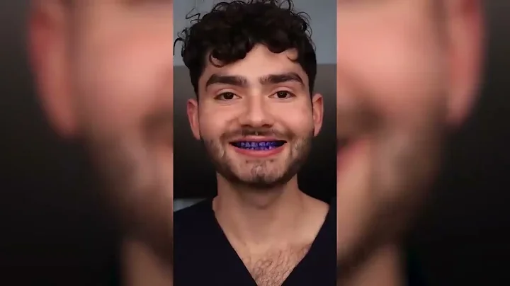 Dental Digest! Does GOLD ASMR Snacks Cause Cavities !_ _short's mukbang_