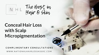 Hair Tattoo - Scalp Micropigmenation (SMP) to Conceal Hair Loss