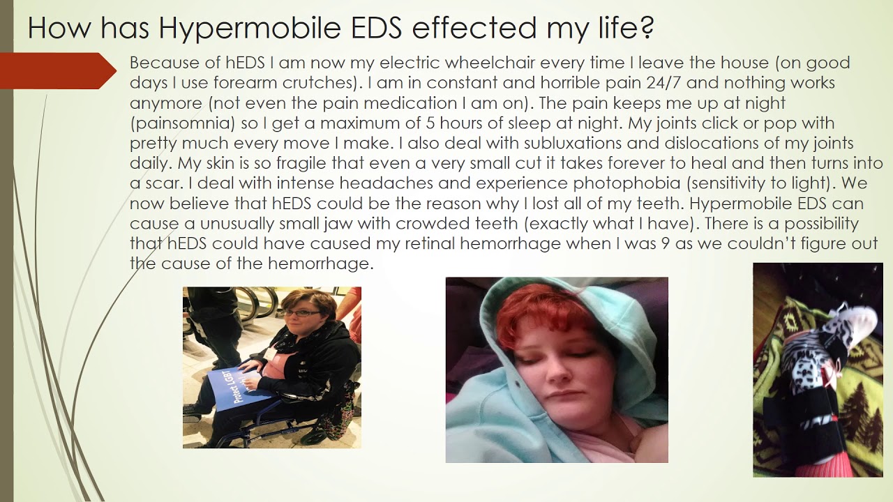 EDS - My Journey to Diagnosis camera iphone 8 plus apk