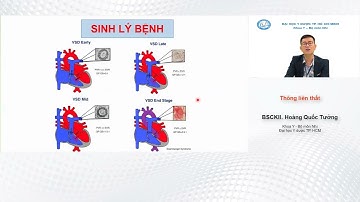 Thông liên thất trẻ em BS.CKII Hoàng Quốc Tưởng - Đại học Y Dược TPHCM YDS