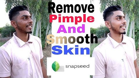 Remove Pimple And Smooth Skin || Easy 2 Steps in Snapseed 🔥🔥