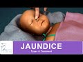 Newborn Jaundice Quiz