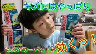 【キズパワーパッド】傷の治りが早い絆創膏を使ってみた⁉
