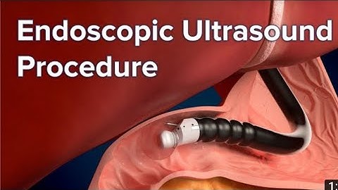 Learning  Endoscopic Ultrasound  (EUS) Tutorial. EUS basics ,Uses ,indications, Tutorials.
