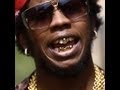 Peter Rosenberg Asks Trinidad James What The F#ck Is Goin On With Ur Teeth (Dam)