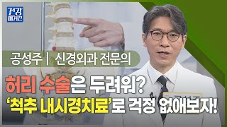 [#건강앤한경] 척추 내시경치료, 허리 통증의 종결자가 될 수 있을까ㅣ2주째 아픈 허리, 척추 내시경치료로 근본 해결하다