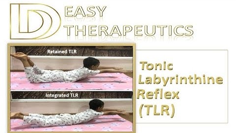 TLR Assessment and Exercises | Tonic Labyrinthine Reflex | Primitive Reflexes