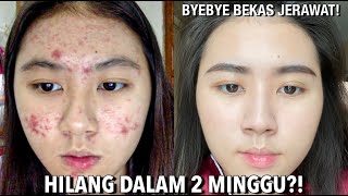 TESTIMONI OPTIMALS EVEN OUT ORIFLAME UNTUK MENGHILANGKAN FLEK HITAM