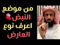 من مكان النبض فقط اعرف إن كان ما بك مس أم سحر أم حسد والحل مع الشيخ فهد القرني