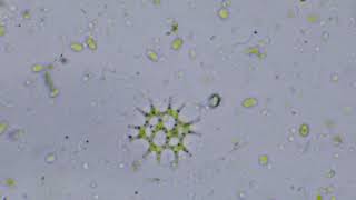 Mikroskopijne Glony I Bakterie Pod Mikroskopem