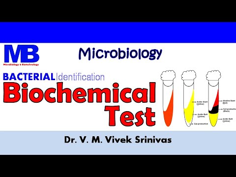 BIOCHEMICAL TEST | Bacterial Identification Technique | Microbiology | Vivek Srinivas |#Bacteriology