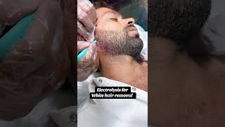 Electrolysis for white hair removal treatment at zunair aesthetics samanabad Faisalabad