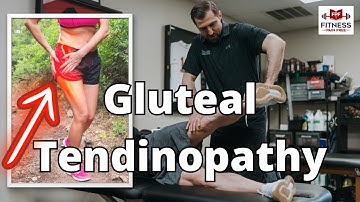 What Physical Therapists Need to Know About Gluteal Tendinopathy