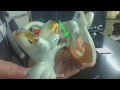 Understanding the Ear: Structure and Function