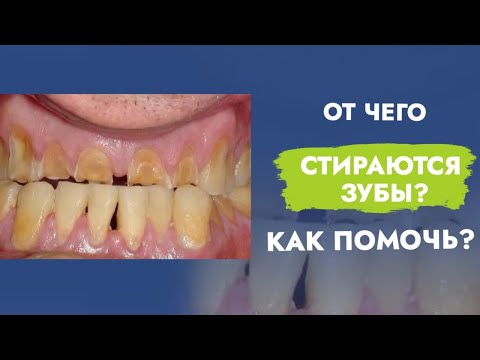 Video: Kad Zubi Nisu Na Mjestu - Alternativni Prikaz