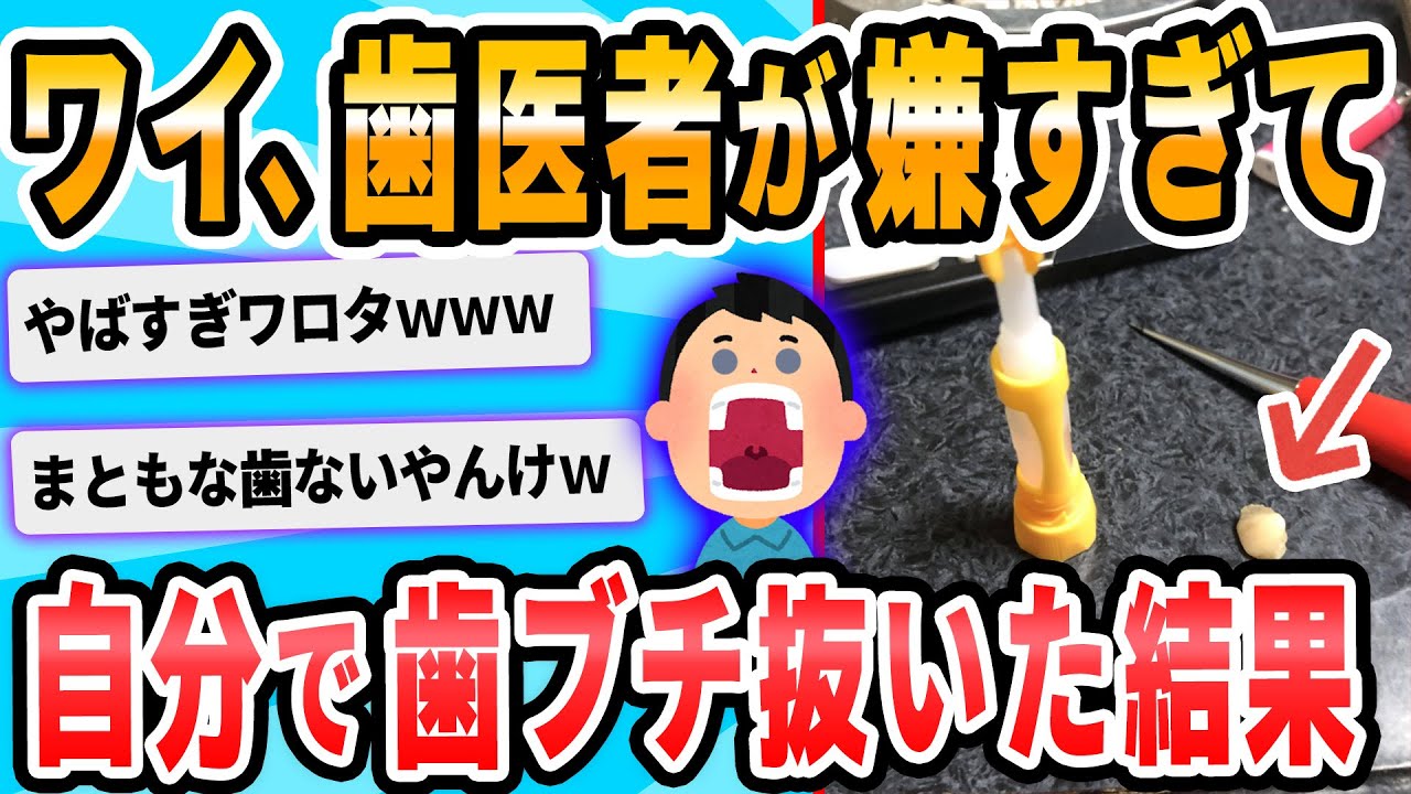 【2ch面白いスレ】虫歯で割れた奥歯をぬこうとしてるだけなのに血だらけ