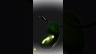 Gallstones May Form If Bile Contains Too Much Cholesterol Or Bilirubin, Or Not Enough Bile Salts