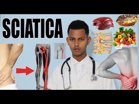 3 VITAMIN OO U WANAGSAN XANUUNKA NEERFAHA DHABARKA ILAA LUGAHA SCIATICA