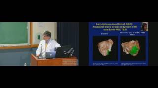 Grand Rounds 2017.03.29 Development of Cardiac Cell Based Therapy...