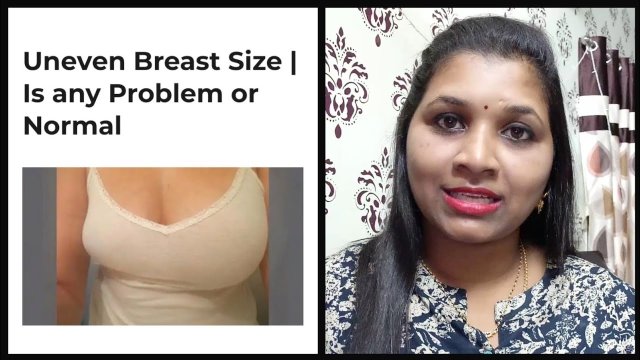 High Alert For Girls ll स्तन बड़ा और 1 छोटा ll uneven breast ll bra haul 