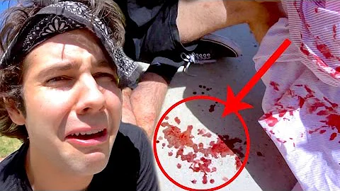 HOW DAVID CUT HIS HANDS OPEN!!