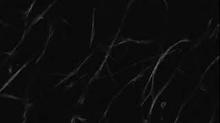 Z-scan of cultured human dermal fibroblasts labelled with Alexa 488 Phalloidin