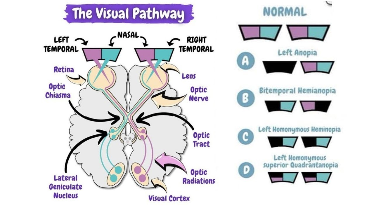 Visual Pathway Explained | Lesions & Visual Field Defects Made Easy