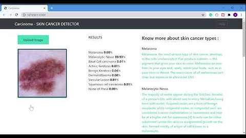 Skin Cancer Detection Flask Web App - TensorFlow | Keras | Flask