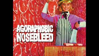 Watch Agoraphobic Nosebleed Die And Get The Fuck Out Of The Way video