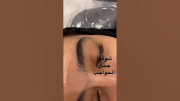 تشقير الحواجب بالليزر شوفوا الجمال 