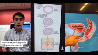 A Brief Introduction to Prostate Cancer