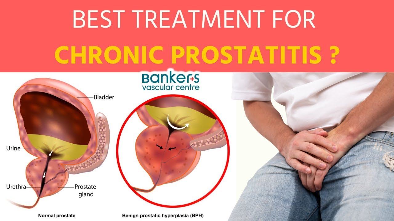 Best treatment for chronic prostatitis ?