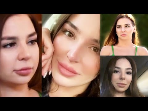 Anfisa Plastic Surgery Transformation Before and After | 90 Day Fiance