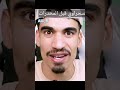الصحراوي قبل وبعد المخدرات فري فاير صحراوي Freefire فريفاير Bugfreefire دراغنوف Bugfree الصحراوي قبل وبعد المخدرات فري فاير صحراوي Freefire فريفاير Bugfreefire دراغنوف Bugfree