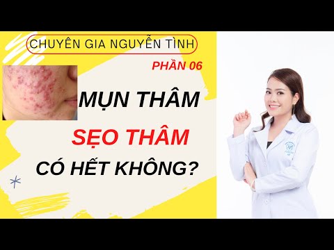 Đánh bay mụn thâm, sẹo thâm sau điều trị mụn - Nguyen Tinh Official