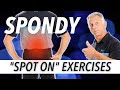 “Spot-On” Exercises For Spondylolisthesis