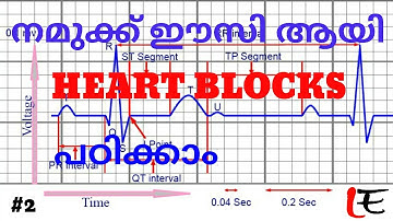 Basics of ECG (episode#2), AV blocks, heart blocks,  1,2,3 degree blocks in Malayalam