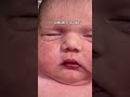 New born baby in NICU #healthcare #hospital #internationallyeducatednurse #medicaltraining #nurse