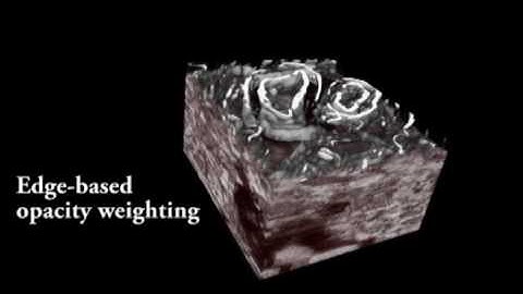 Scalable and Interactive Segmentation and Visualization of Neural Processes in EM Datasets