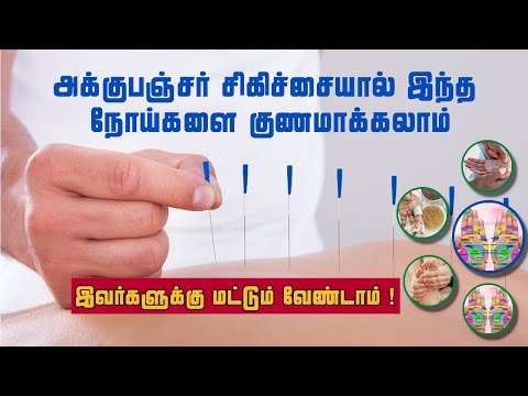 அக்குபஞ்சர் சிகிச்சை முறைகள் | நோய்களுக்கான தீர்வுகள்