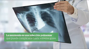 ¿Cuáles son los síntomas específicos que nota el médico para confirmar que se trata de una neumonía?