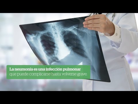 Video: ¿Qué tan grave es la neumonía multilobar?