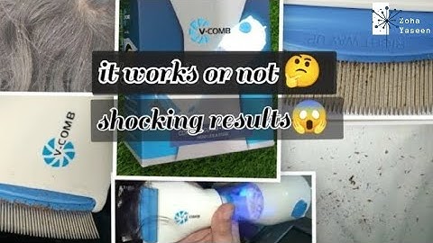 V_comb Anti lice Machine |Unboxing, Price, Review & How to use| Complete Guide and honest review